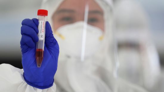Кръвна група А може да се окаже рискова за развитие на усложнения при COVID-19 заради по-активното кръвосъсирване