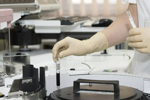 Merck започва изпитване в последна фаза на лекарство за Covid-19